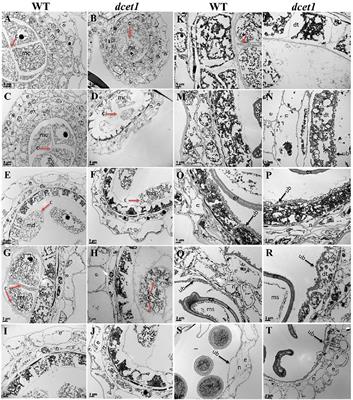 Frontiers | DCET1 Controls Male Sterility Through Callose Regulation ...